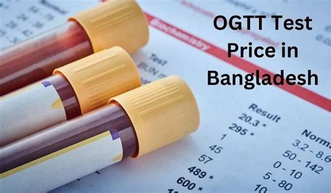 √ OGTT Test Price and Types Philippines 2024 .